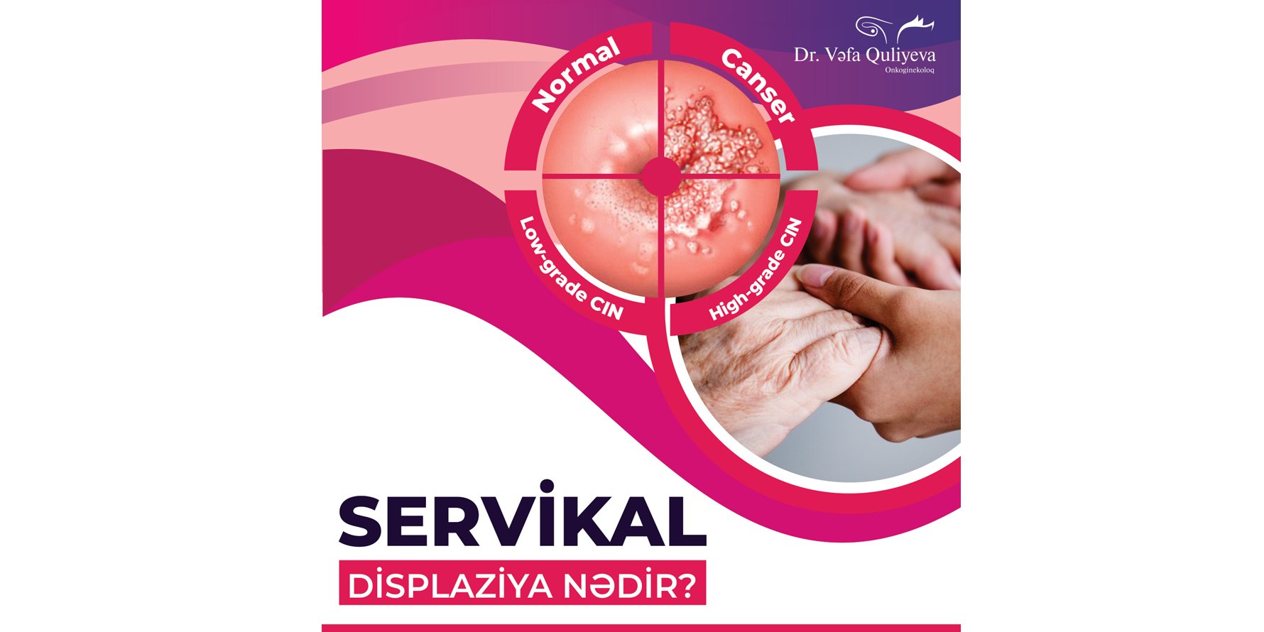 Servikal displaziya haqqında!