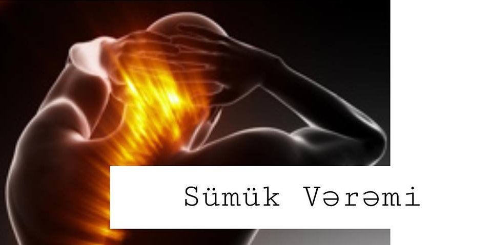 Sümük vərəmi