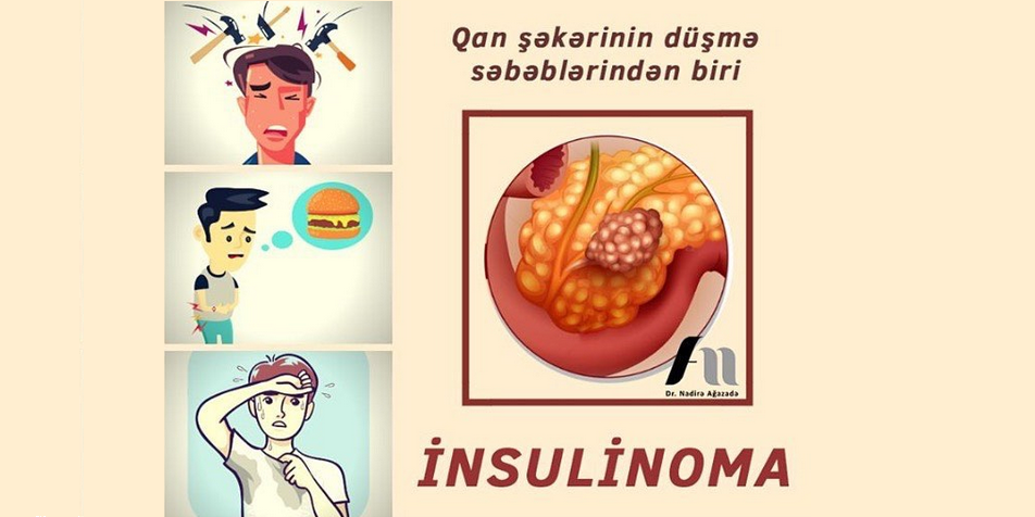 İnsulinoma