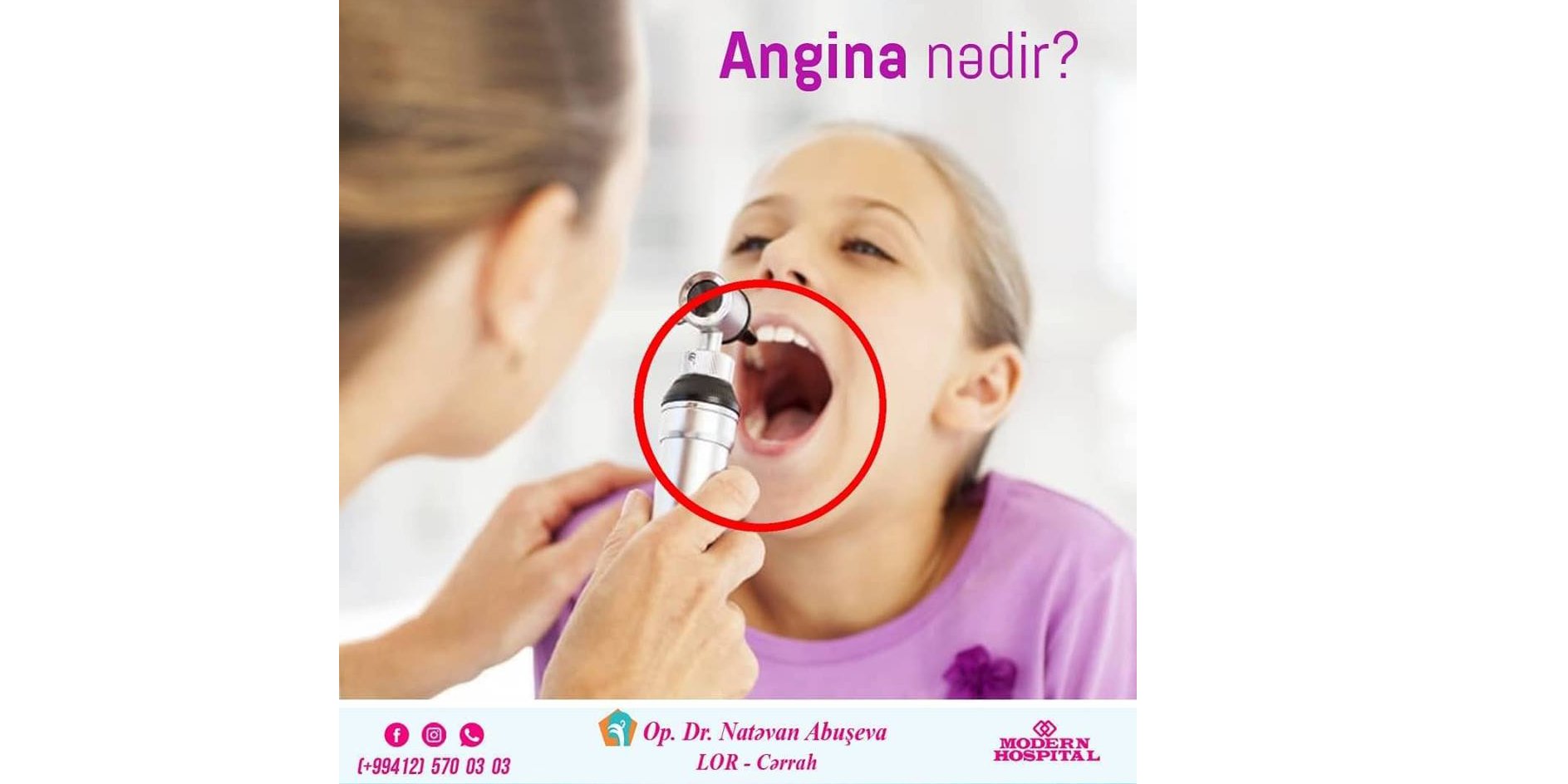 Angina nədir?