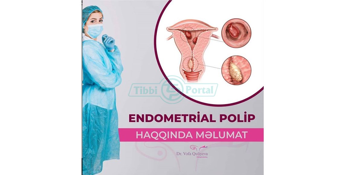 Endometrial polip nədir?