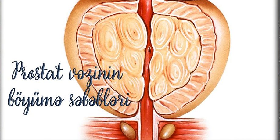 Prostat vəzinin böyümə səbəbləri