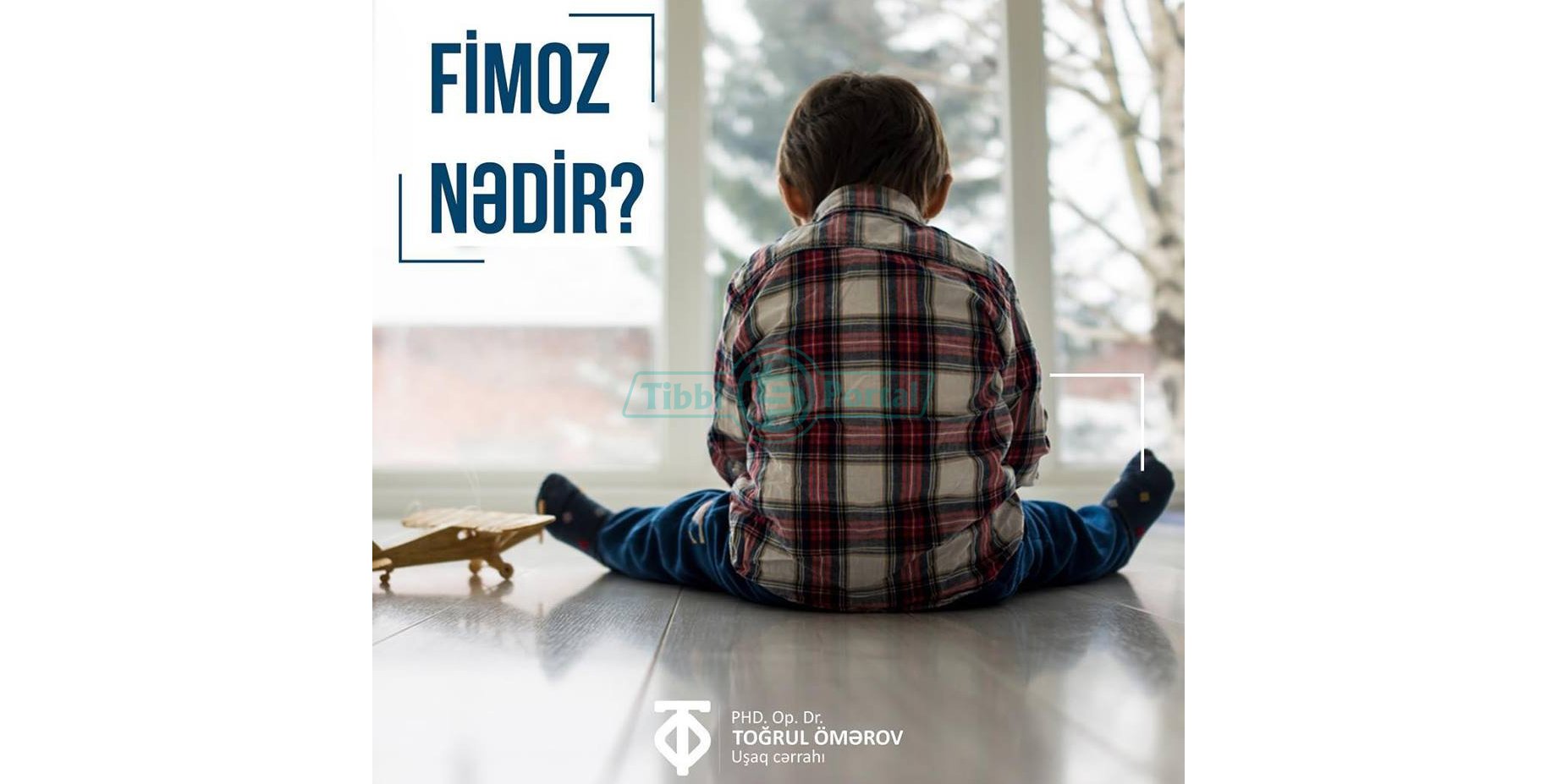 Fimoz nədir?