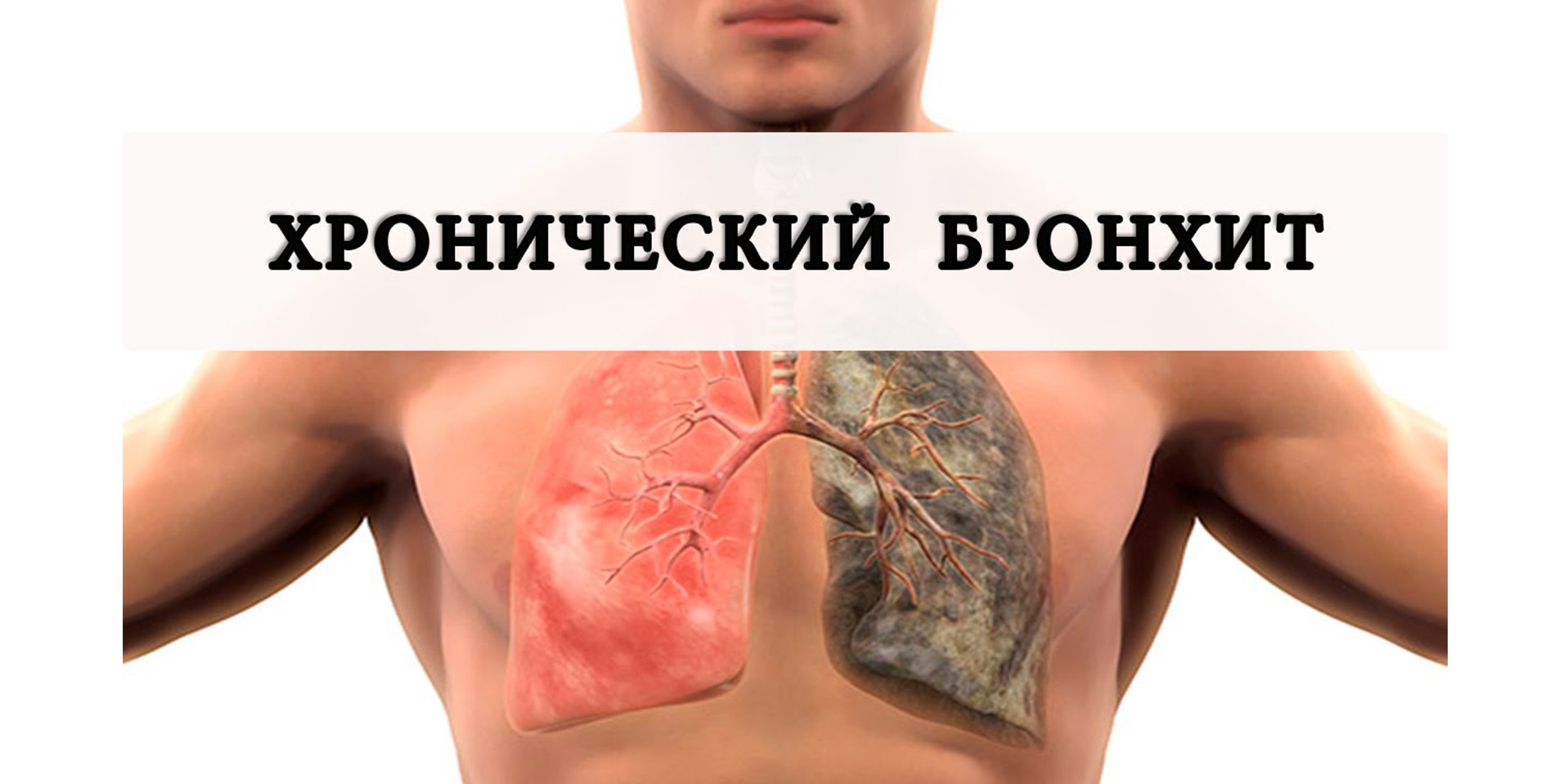 Xəstəlik