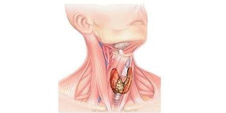 Anaplastik tiroid xərçəngi