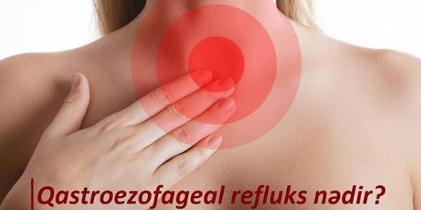 Qastroezofageal refluks nədir?