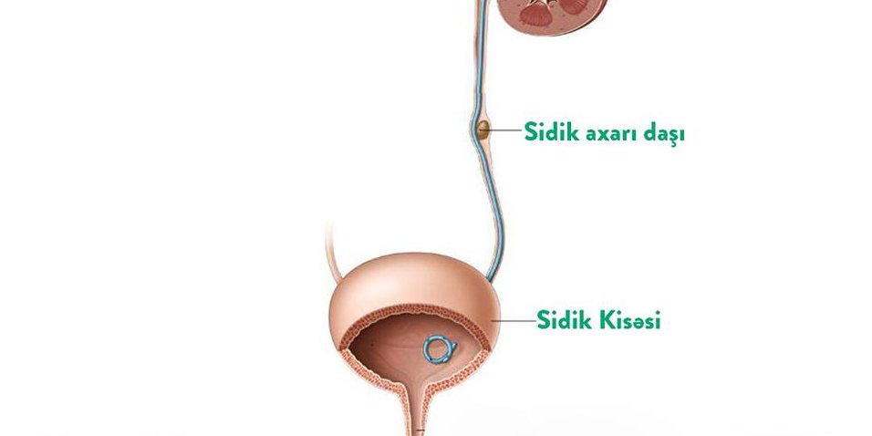 Sidik axarı daşı