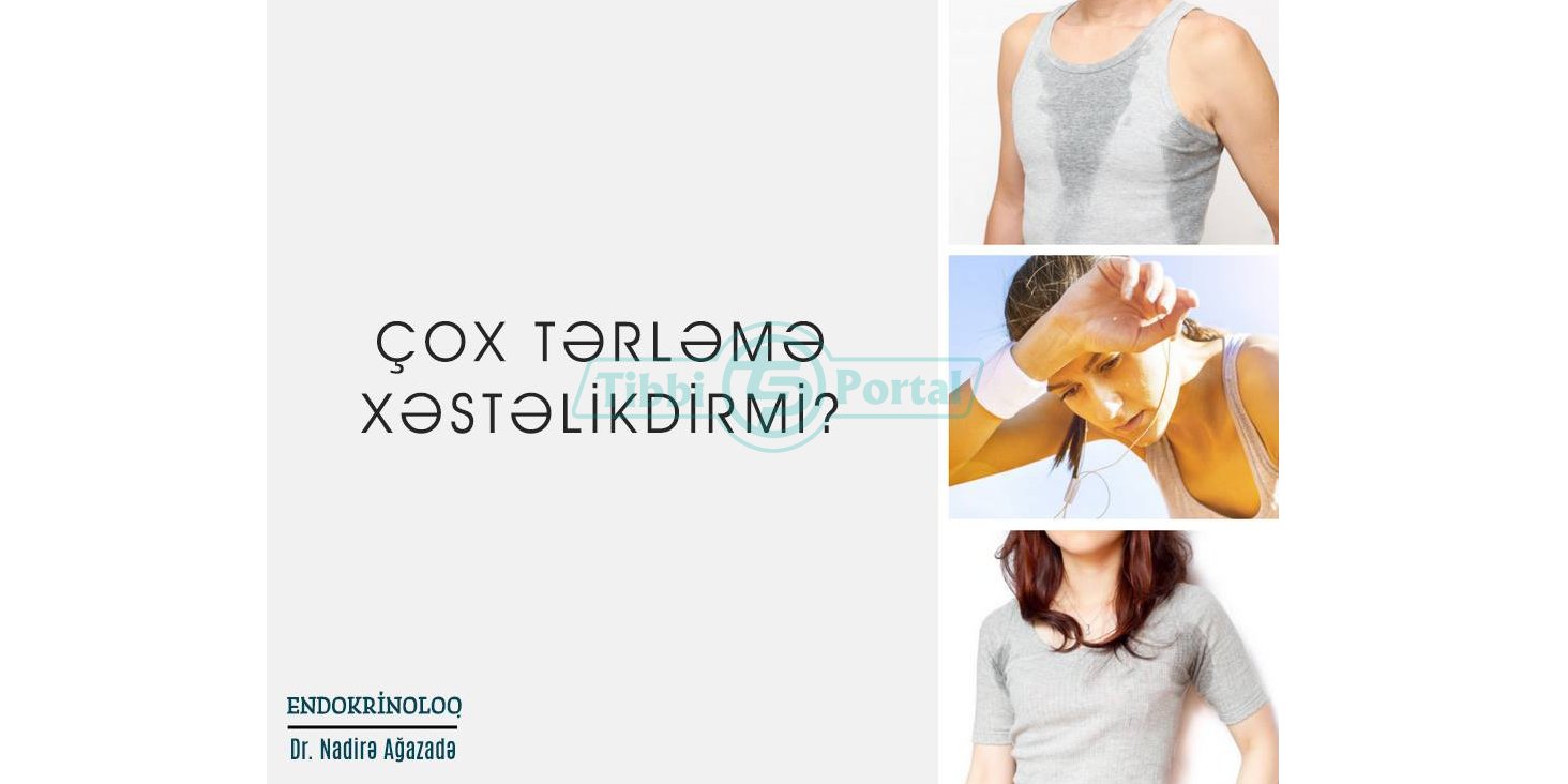 Çox tərləmə xəstəlikdirmi?